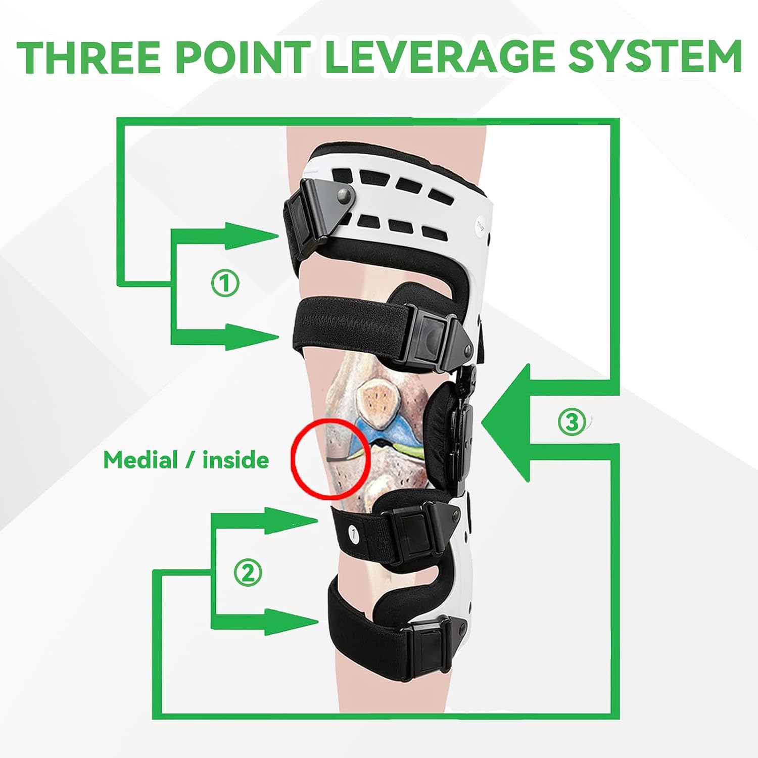 Orthomen OA Unloader Knee Brace, Support for Arthritis Pain, Osteoarthritis, Cartilage Defect Repair, Avascular Necrosis, Bone on Bone Knee Joint Pain and Degeneration Medial Inside Right