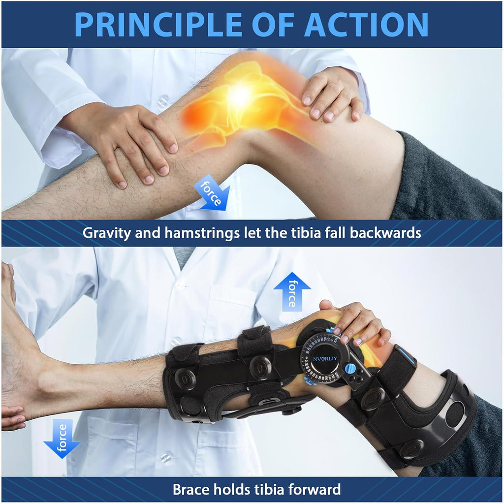 Nvorliy Knee Brace for Functional Posterior Cruciate Ligament (PCL) Recovery Stabilization, Adjustable Medical Post-Op Orthosis for Post-Surgery Support, Women and Men (Left, Medium)